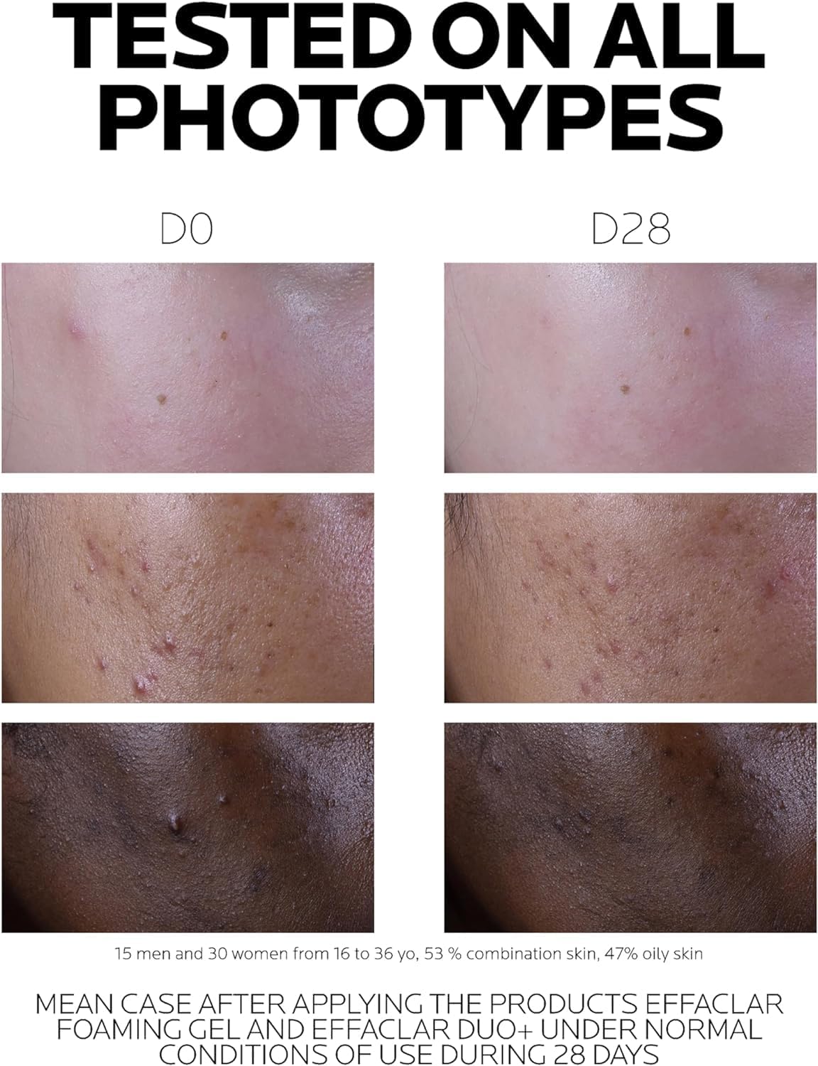 La Roche-Posay Effaclar Duo+ SPF30 40ml - Image 7